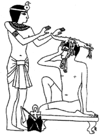 Cura per l'emicrania nell' antico Egitto